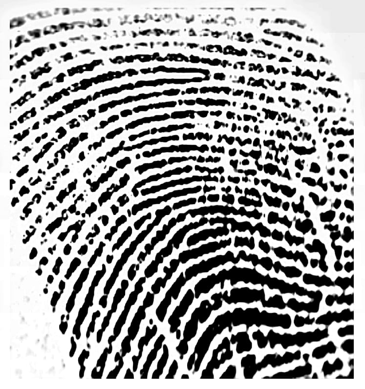 linie papilarne
